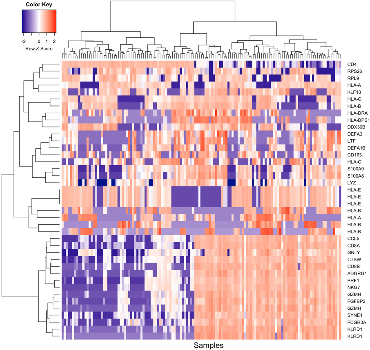 Clustered heatmap of the forty most variable transcripts in CD4 and CD8 T cells from patients with giant cell arteritis